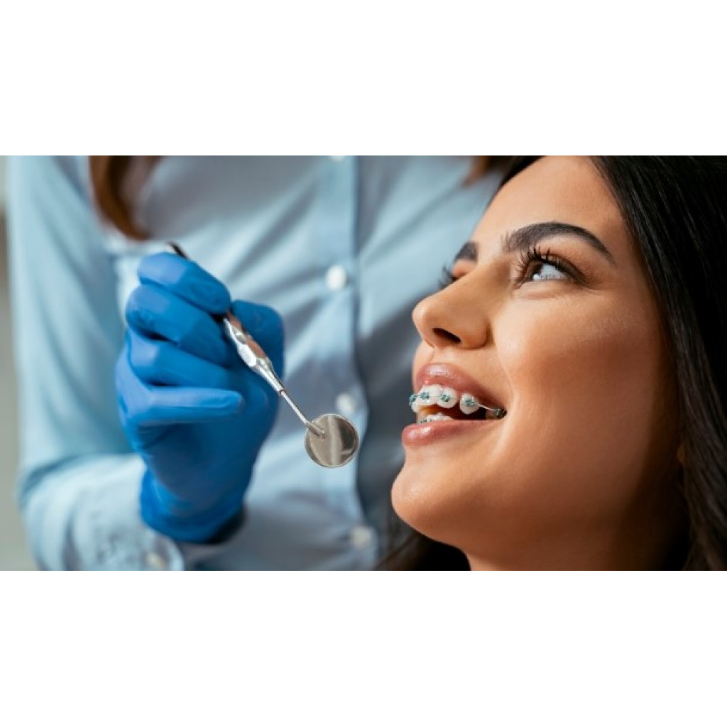 Benefits of Braces for Adults